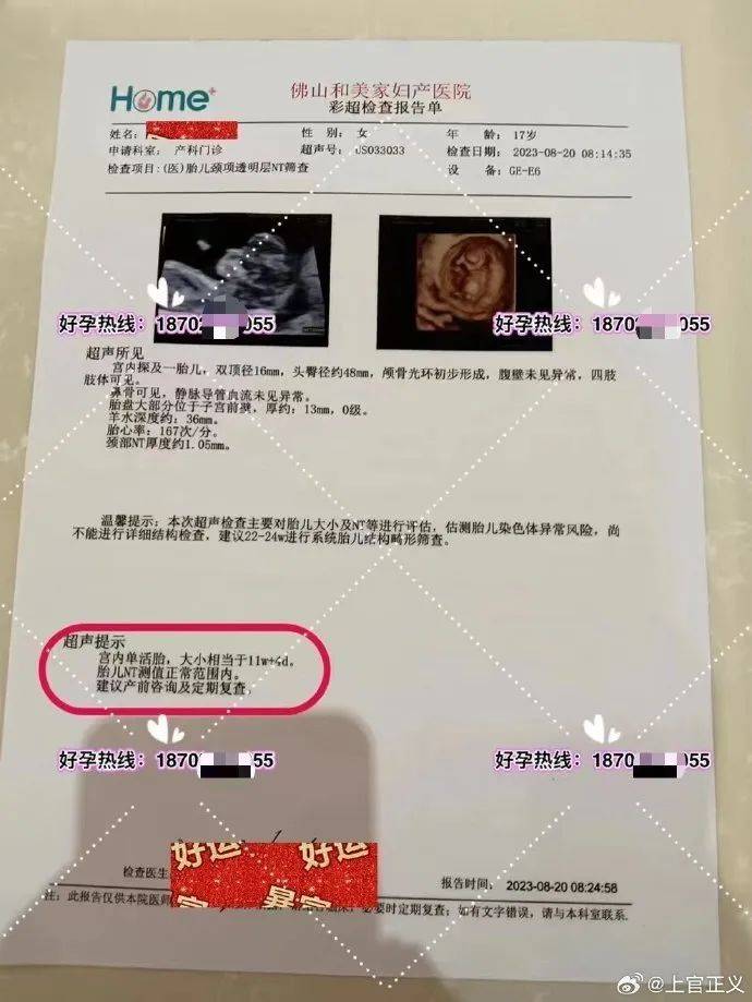 17岁彝族少女被曝为50岁男子代孕<strong></p>
<p>神原油</strong>，今年2月产下双胞胎
