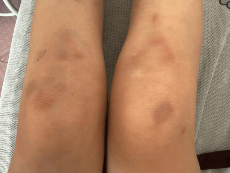 女子自称因工资问题被老板锁办公室里打 警方：双方已到派出所<strong></p>
<p>融原油</strong>，是否打人还在调查
