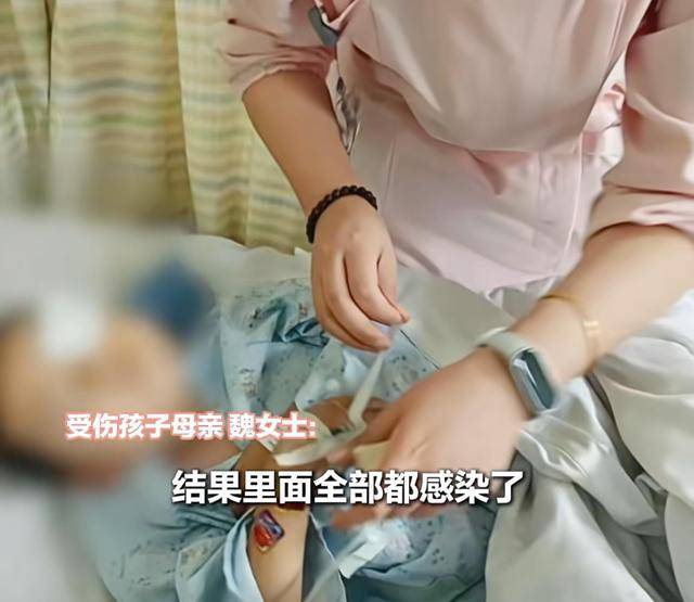 江西一5岁男孩在幼儿园被戳伤致左眼失明<strong></p>
<p>原油户</strong>，家长称老师用猪油涂抹试图消肿